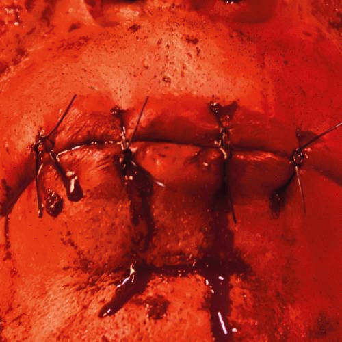 Lindemann : Zunge (Single)